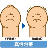 かわいい おちんちん