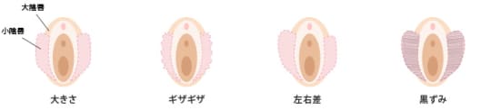 女性器