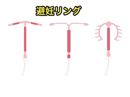 避妊リング