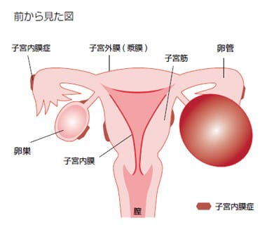 手マン腹痛