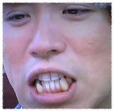 アップで映るとキツい 歯並びの悪い芸能人をまとめてみた Miima ミーマ