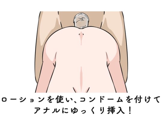 アナルプレイ