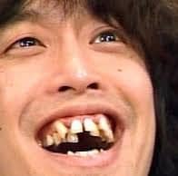 アップで映るとキツい 歯並びの悪い芸能人をまとめてみた Miima ミーマ