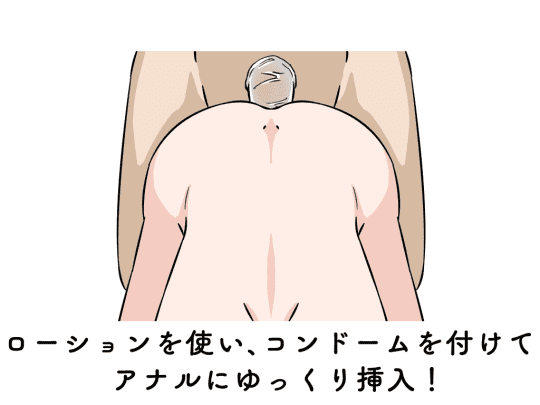 アナルセックス