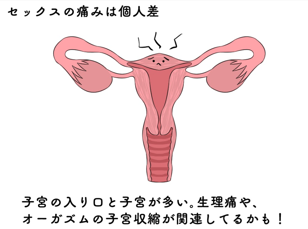 エッチ バック 痛い