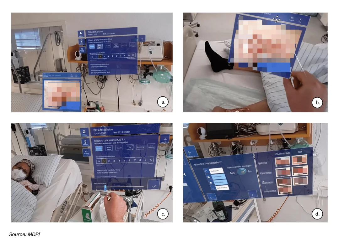 AR Application for Wound Care Management