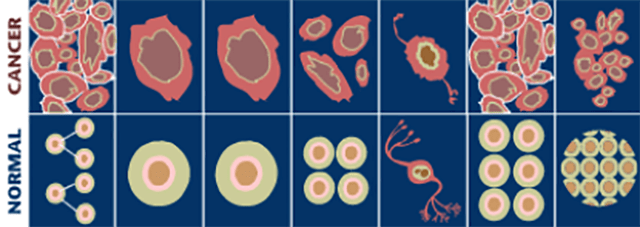 Normal vs cancer cells