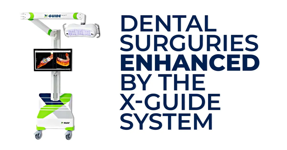 Dental Surgeries Enhanced by The X-Guide System: Elevating Dentist and Patient Experiences