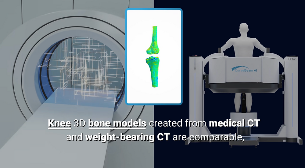Case Study: CurveBeam AI Turns Scientific Proof into Advantage