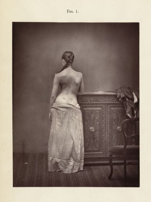 Fig. 1 Sayre, Lewis A.  (American, 1820-1900)