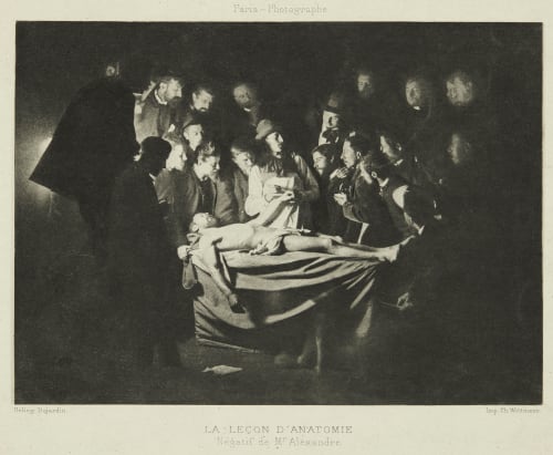 La Lecon D’Anatomie, Négatif de Mr. Alexandre Alexandre  (French)