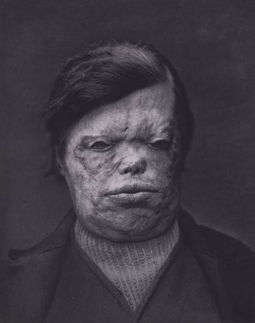 Pl. X Arents, Pierre  (French)