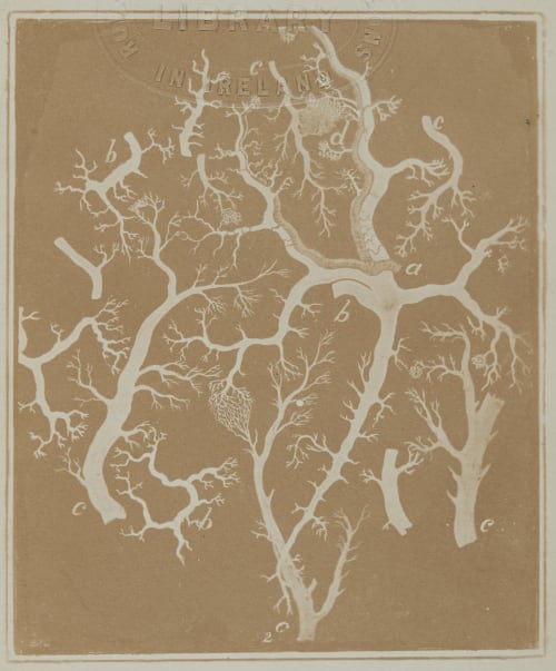 Part of the Surface of an Injected Human Liver Beale, Lionel S.  (British, 1828-1906)