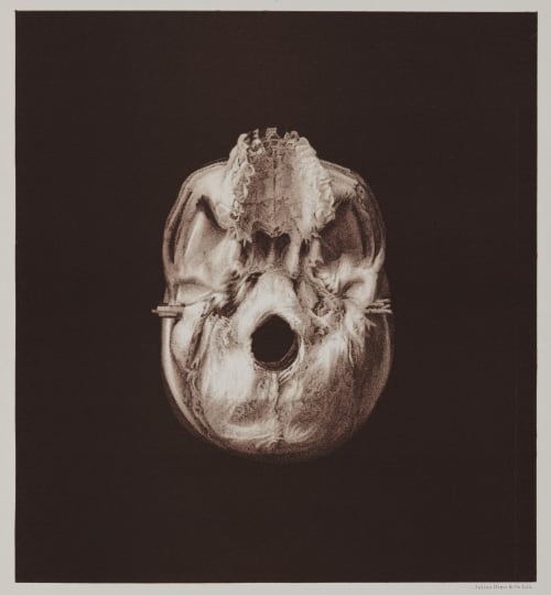 Arrangement for Taking Composite Photographs of Skulls, Photograph No. 1 Bien, Julius  (American, 1826-1909)