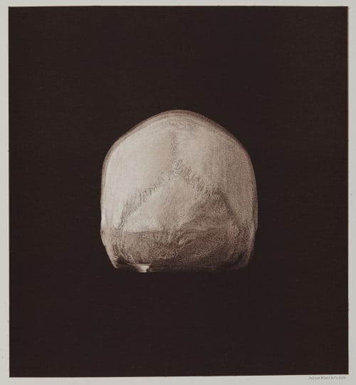 Arrangement for Taking Composite Photographs of Skulls, Photograph No. 1 Bien, Julius  (American, 1826-1909)