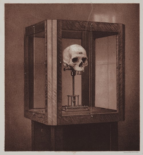 Arrangement for Taking Composite Photographs of Skulls, Photograph No. 1 Bien, Julius  (American, 1826-1909)