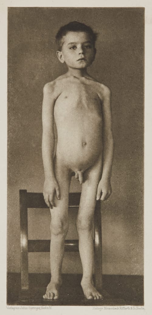 Tafel 4 Curschmann, Dr. H.  (German, 1846-1910)