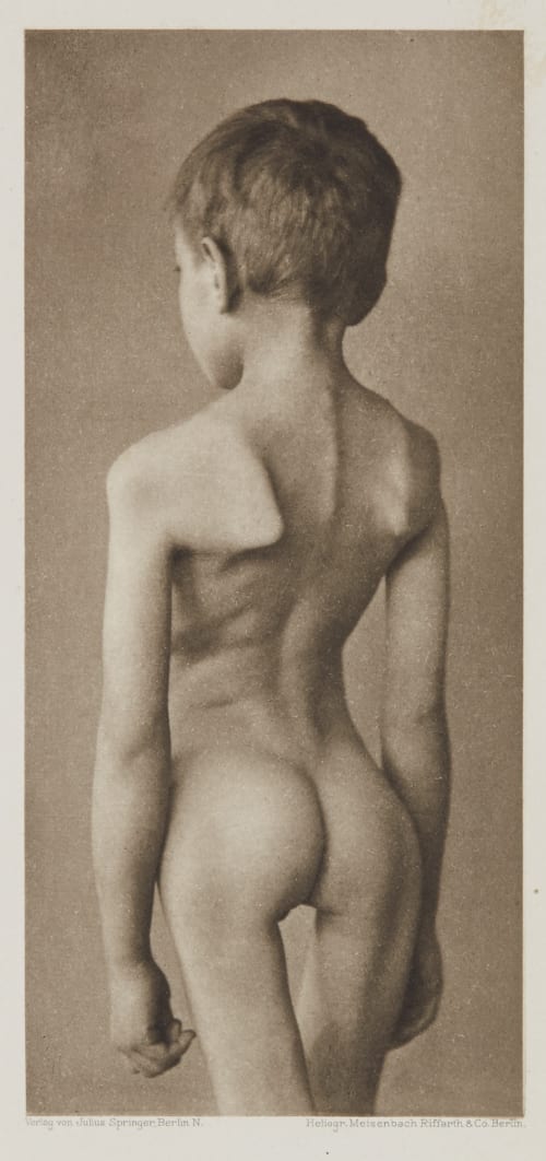 Tafel 5 Curschmann, Dr. H.  (German, 1846-1910)