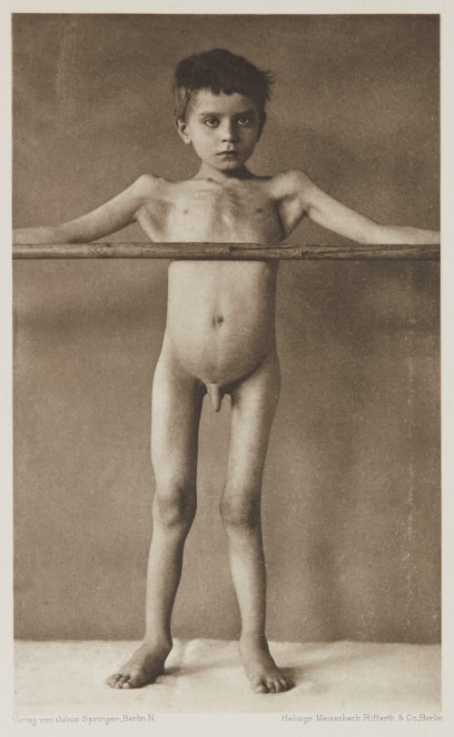 Tafel 6 Curschmann, Dr. H.  (German, 1846-1910)