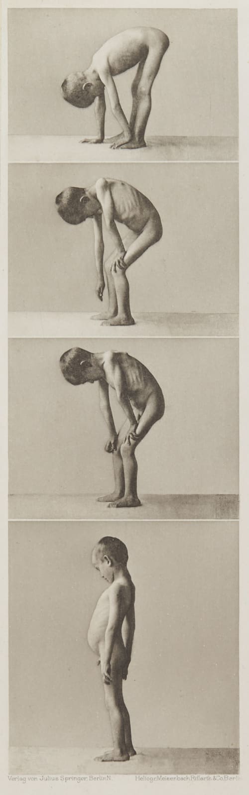 Tafel 8 Curschmann, Dr. H.  (German, 1846-1910)