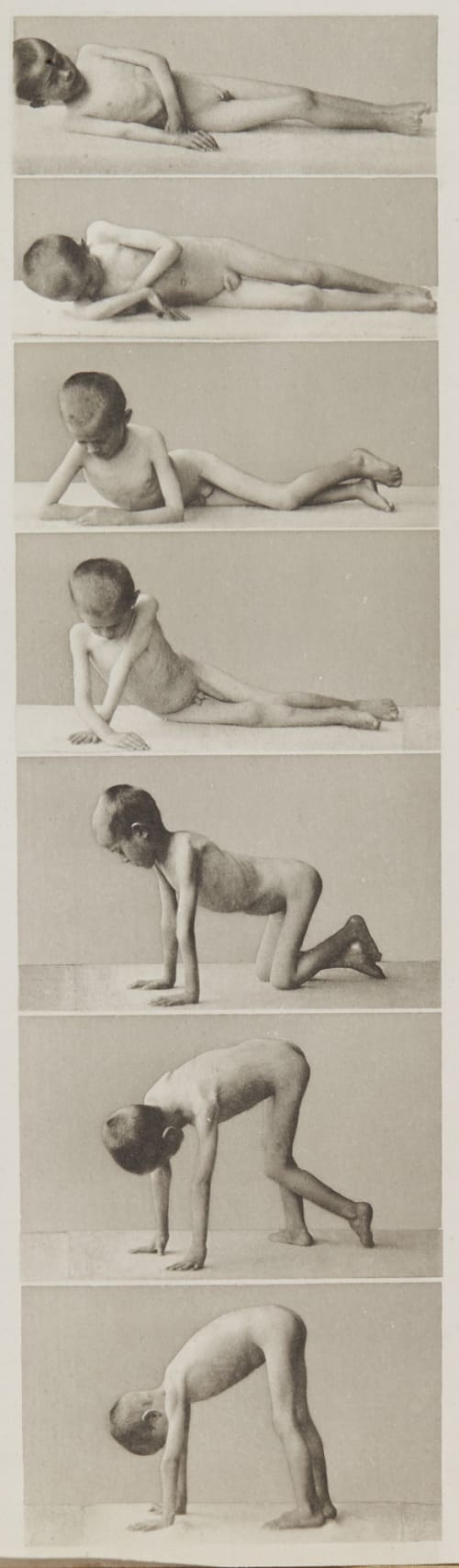 Tafel 8 Curschmann, Dr. H.  (German, 1846-1910)