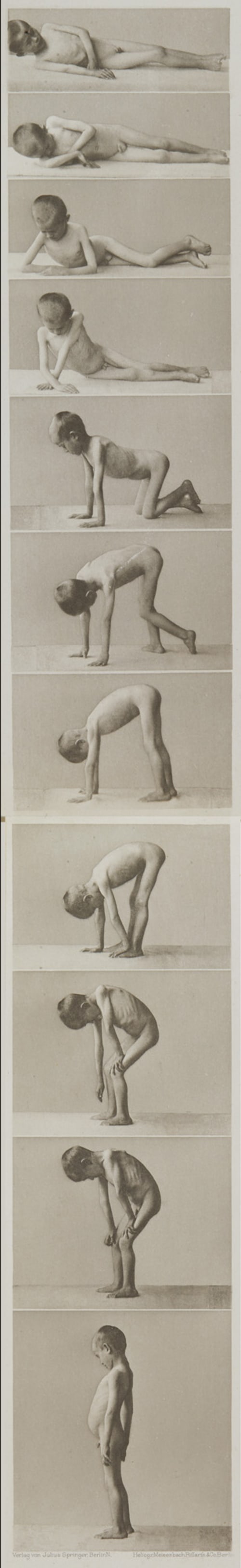 Tafel 8-9 Curschmann, Dr. H.  (German, 1846-1910)