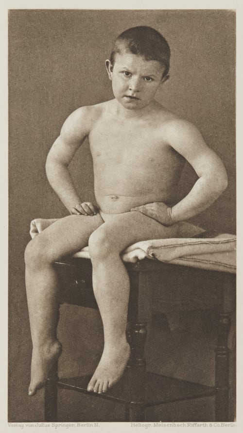 Tafel 10 Curschmann, Dr. H.  (German, 1846-1910)