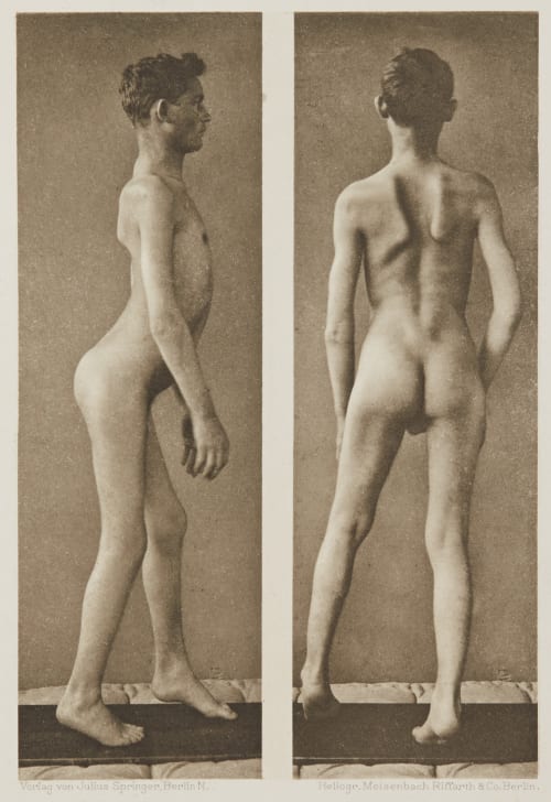 Tafel 11 Curschmann, Dr. H.  (German, 1846-1910)
