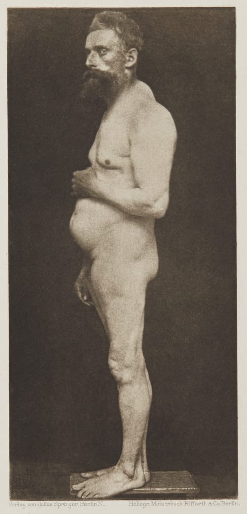 Tafel 14 Curschmann, Dr. H.  (German, 1846-1910)