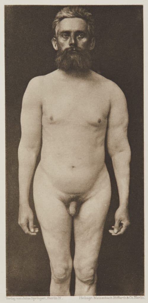 Tafel 15 Curschmann, Dr. H.  (German, 1846-1910)