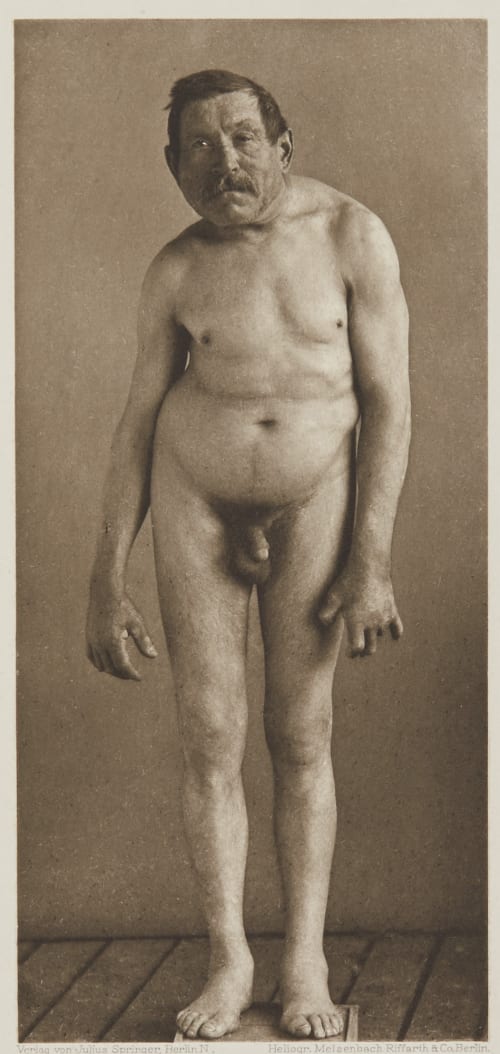 Tafel 18 Curschmann, Dr. H.  (German, 1846-1910)