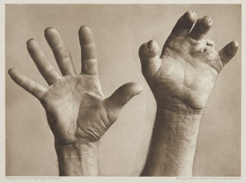 Tafel 21 Curschmann, Dr. H.  (German, 1846-1910)