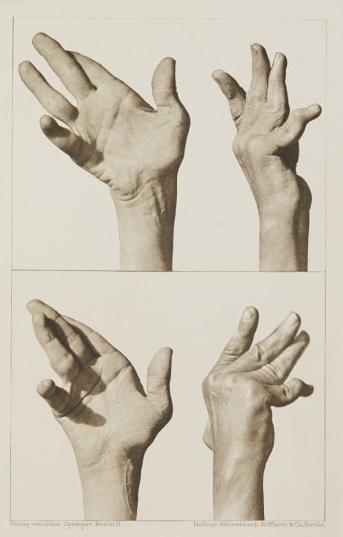 Tafel 29 Curschmann, Dr. H.  (German, 1846-1910)