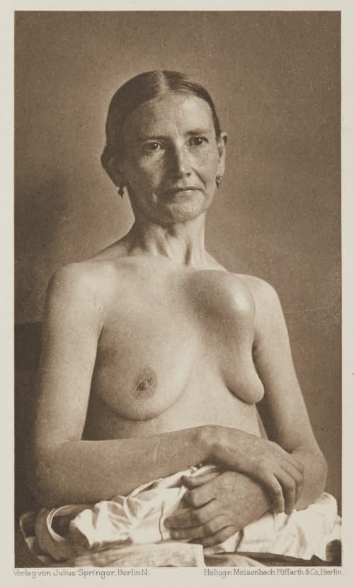 Tafel 45 Curschmann, Dr. H.  (German, 1846-1910)