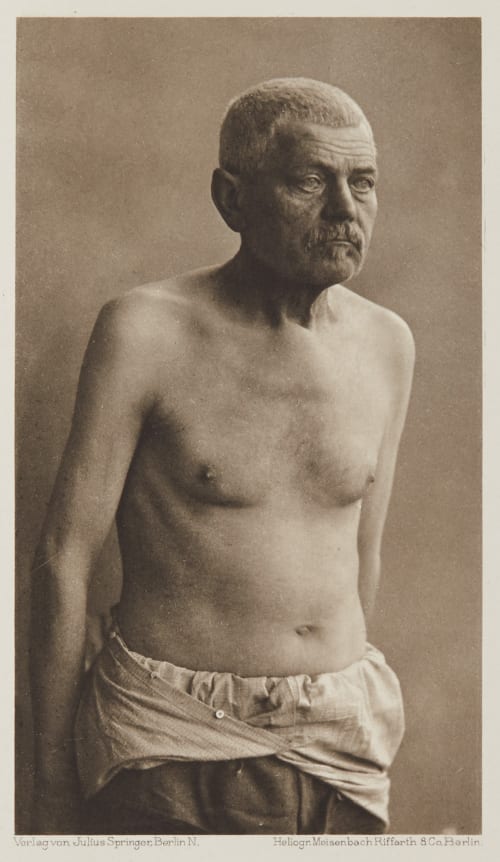 Tafel 46 Curschmann, Dr. H.  (German, 1846-1910)