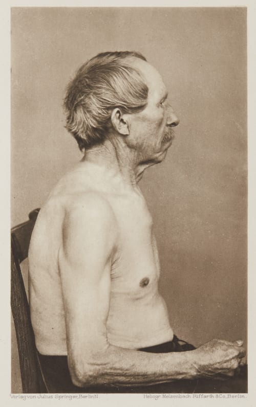 Tafel 47 Curschmann, Dr. H.  (German, 1846-1910)