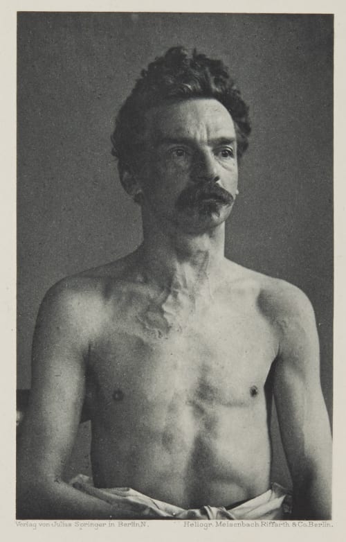 Tafel 52 Curschmann, Dr. H.  (German, 1846-1910)