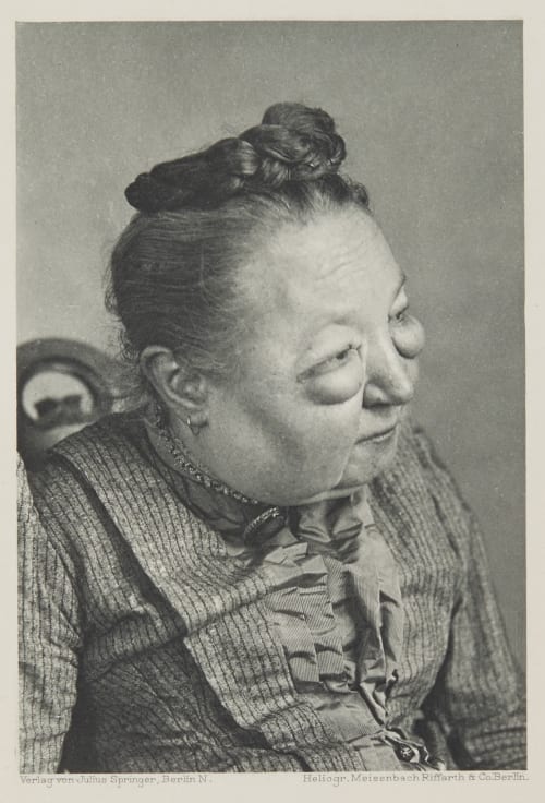 Tafel 53 Curschmann, Dr. H.  (German, 1846-1910)