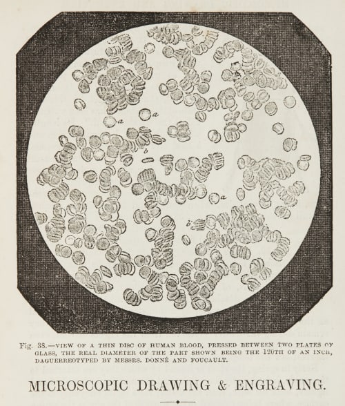 View of a thin disc of human blood. Donné, Alfred  (French, 1801-1878)