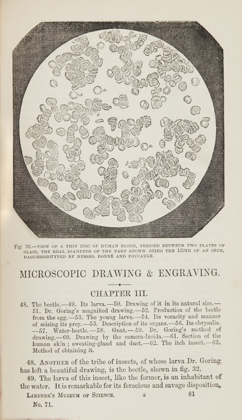Fig. 38 – View of a Thin Disk of Human Blood Donné, Alfred  (French, 1801-1878)