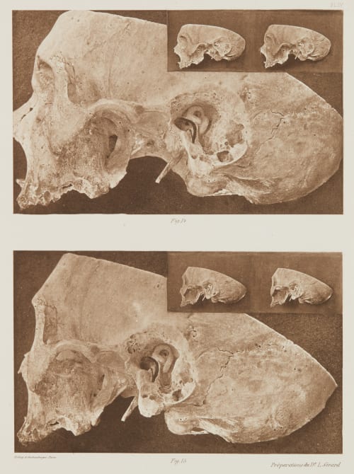 Planche IV Girard, Louis  (French)