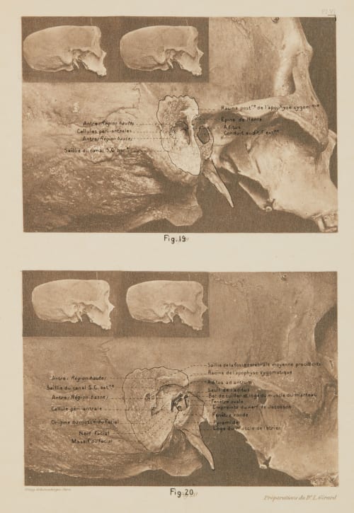 Planche VI (overlay) Girard, Louis  (French)