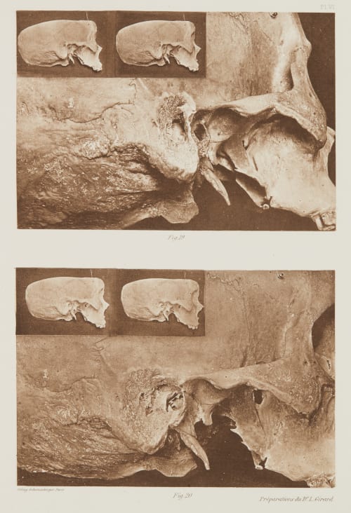 Planche VI Girard, Louis  (French)