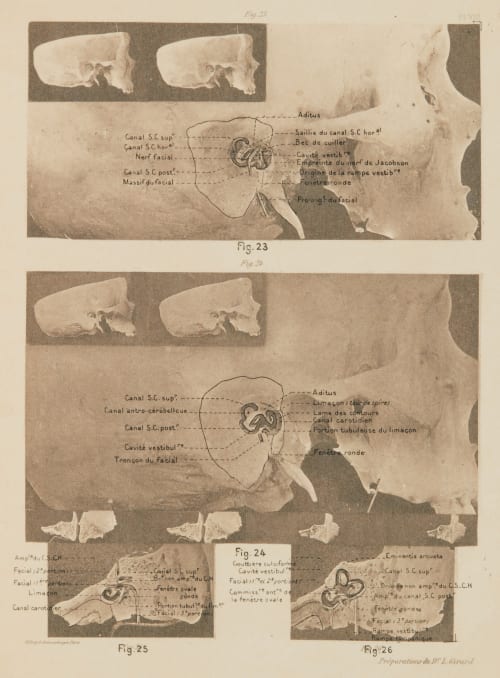 Planche VIII (overlay) Girard, Louis  (French)