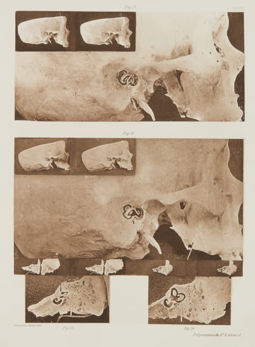 Planche VII Girard, Louis  (French)