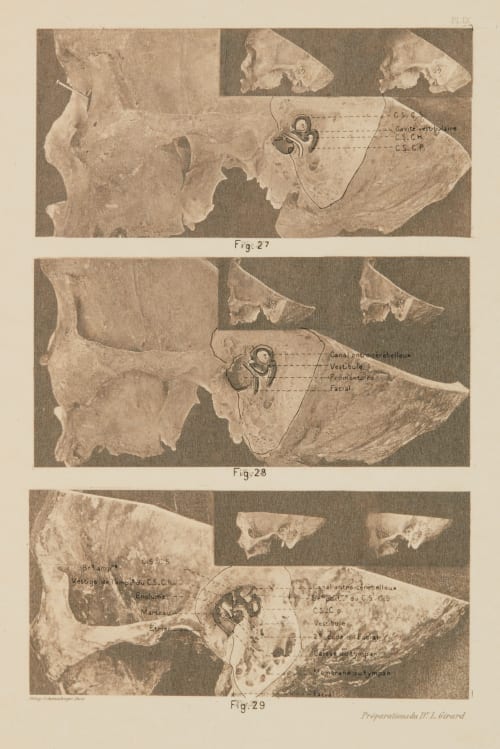 Planche IX (overlay) Girard, Louis  (French)
