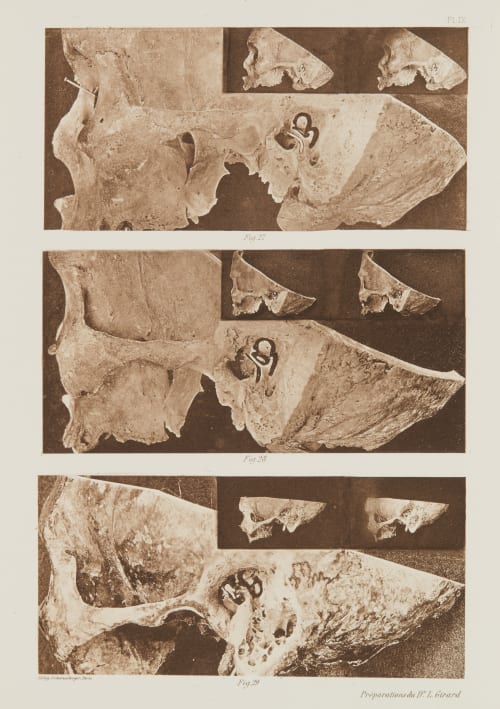 Planche IX Girard, Louis  (French)