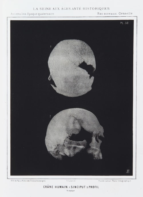 Crâne Humain. 1. Sinciput 2. Profil Bilordeaux, Adolphe  (French, 1807-1872)