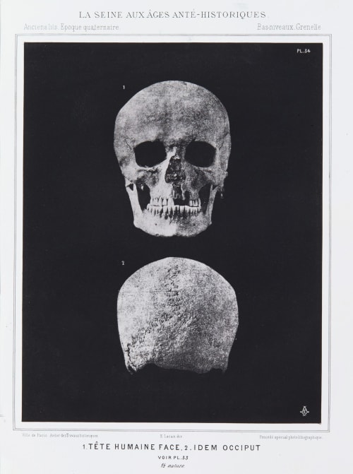 1. Tête humaine face, 2. idem occiput Bilordeaux, Adolphe  (French, 1807-1872)