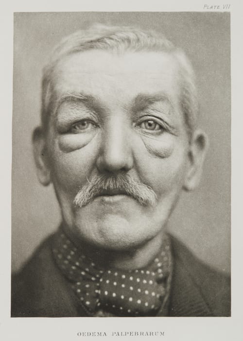 Plate VII, Oedema Ramsay, A Maitland  (Scottish, 1859-1946)